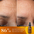 Before and after comparison of a participant’s forehead over 4 weeks, with a white dotted circle highlighting a visible reduction in the look of fine lines and wrinkles. The bottom of the image features a warm orange-gold background with a Medik8 C-Tetra Luxe serum bottle and the claim  86% reported that it was the best Vitamin C serum they had ever tried*. 