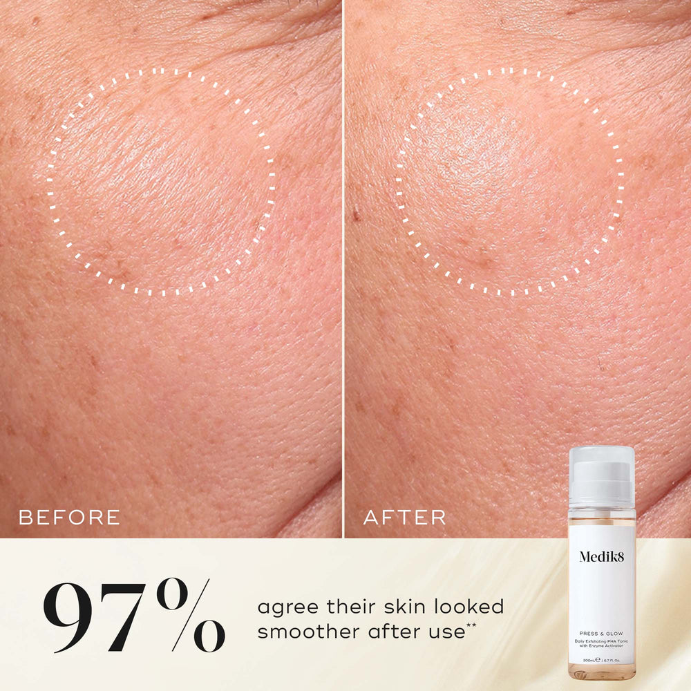 Before and after close-up of a participant’s skin on the cheek, demonstrating a smoother texture and more even appearance. The Medik8 Press & Glow tonic bottle is shown in the corner. Text highlights that  97% agree their skin looked smoother after use**. 