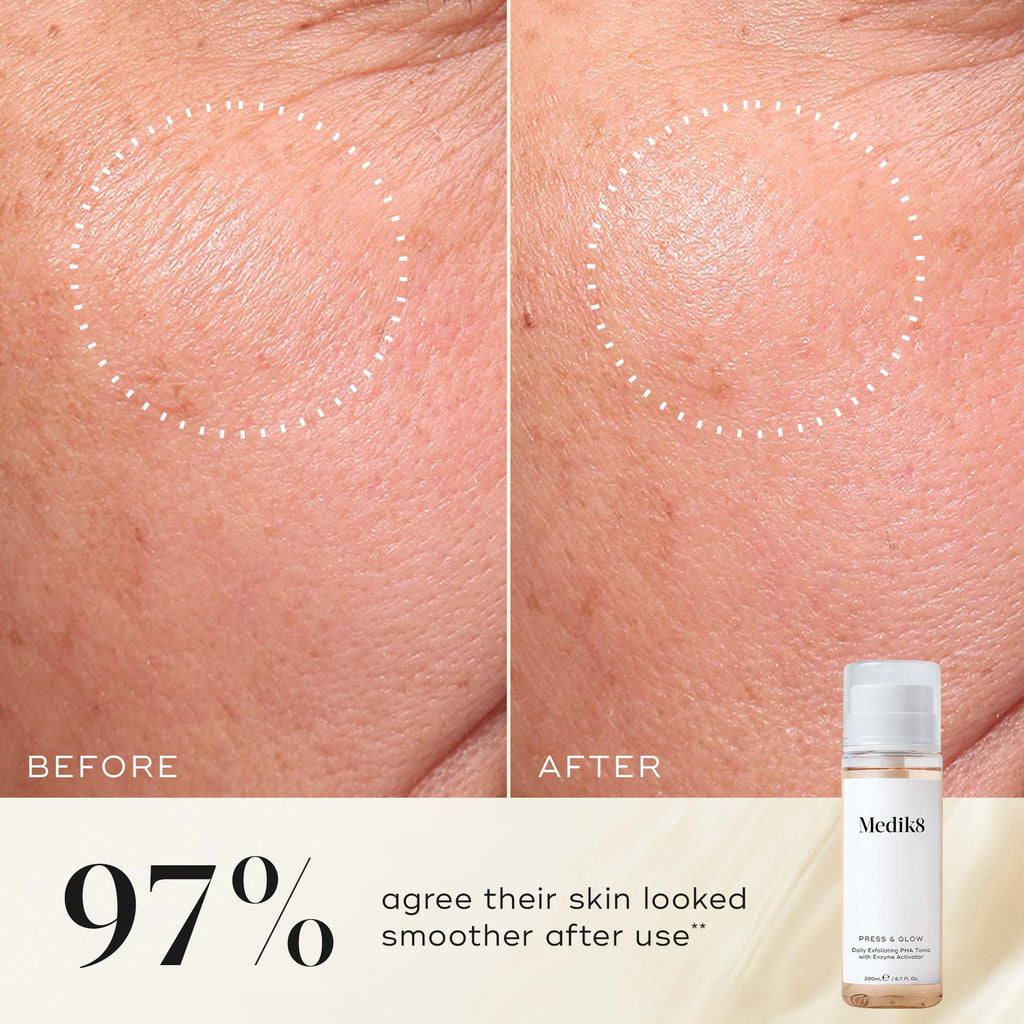 Before and after close-up of a participant’s skin on the cheek, demonstrating a smoother texture and more even appearance. The Medik8 Press & Glow tonic bottle is shown in the corner. Text highlights that  97% agree their skin looked smoother after use**. 