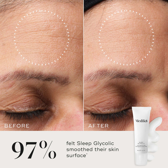Before and after close-up of a participant’s skin on the forehead, demonstrating a visibly smoother skin texture and refined appearance. The Medik8 Sleep Glycolic tube and a white cream texture swipe are shown in the corner against a neutral background. Text highlights that  97% felt Sleep Glycolic smoothed their skin surface*. -hover-10