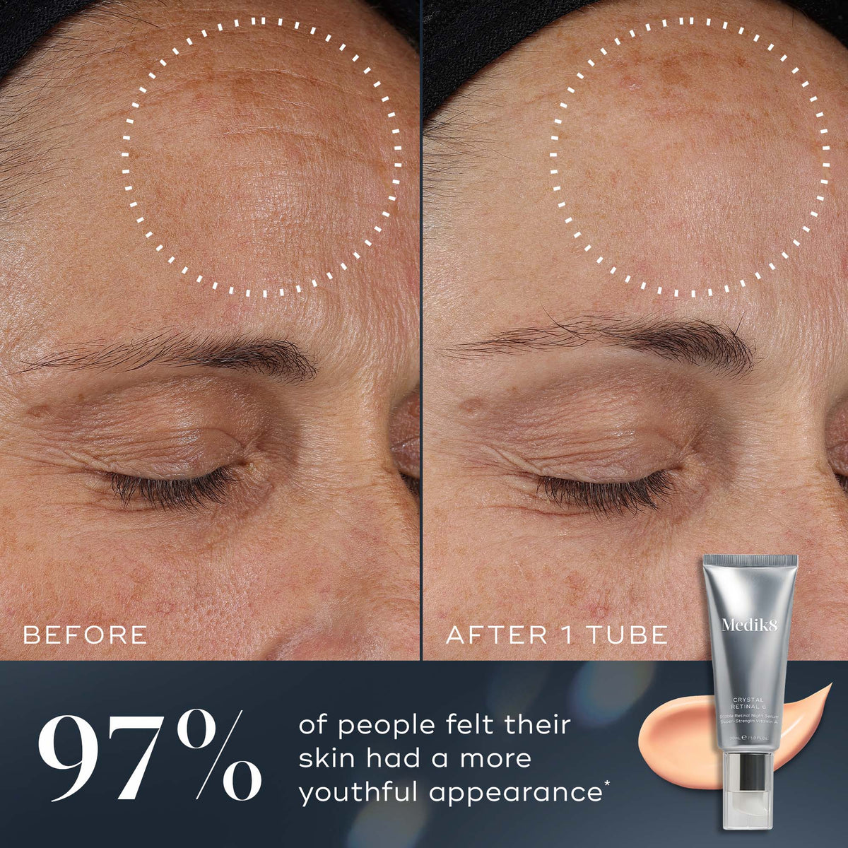 97% - A before-and-after comparison of a participant's forehead shows visibly improved skin after one tube of Medik8 Crystal Retinal. Text states 97% of people felt their skin had a more youthful appearance.