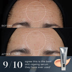 9/1- - A before-and-after comparison of a person's forehead shows visible improvement in fine lines and wrinkles after one tube of Crystal Retinal. Text states 9/10 agree this is the best anti-ageing serum they have ever used.