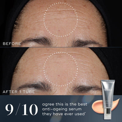 9/1- - A before-and-after comparison of a person's forehead shows visible improvement in fine lines and wrinkles after one tube of Crystal Retinal. Text states 9/10 agree this is the best anti-ageing serum they have ever used.