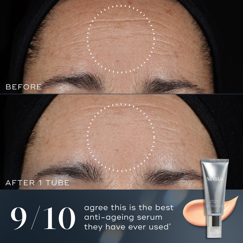 9/1- - A before-and-after comparison of a person's forehead shows visible improvement in fine lines and wrinkles after one tube of Crystal Retinal. Text states 9/10 agree this is the best anti-ageing serum they have ever used.