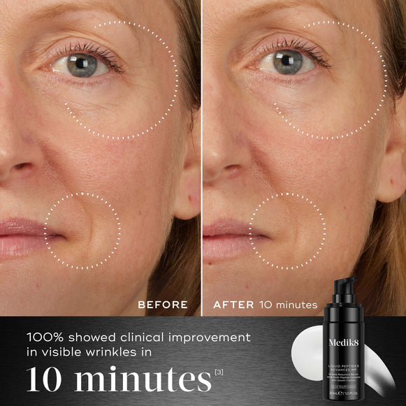 10 Min -  Before and after comparison of a participant’s face displayed next to the Medik8 Liquid Peptides Advanced MP bottle. Visuals demonstrate reduced wrinkles around the eyes and mouth. Text highlights that 100% showed clinical improvement in visible wrinkles in 10 minutes.-hover-3