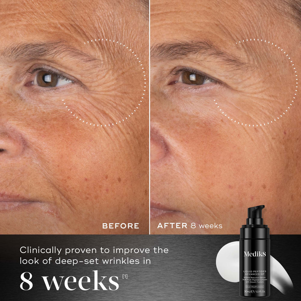 After 8 weeks comparison shows the eye and cheek area of a person, illustrating a reduction in the look of deep-set wrinkles. Below the images, text states  Clinically proven to improve the look of deep-set wrinkles in 8 weeks 