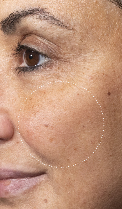 Before and after comparison of a participant’s skin over 7 days, showing visibly brighter skin with improved radiance and even tone.