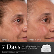 7 days - Before and after comparison of a participant’s eye area over 7 days displayed next to the Medik8 Advanced Pro-Collagen+ Peptide Cream jar. Text highlights that the product is proven to visibly reduce the depth of wrinkles in 7 days.