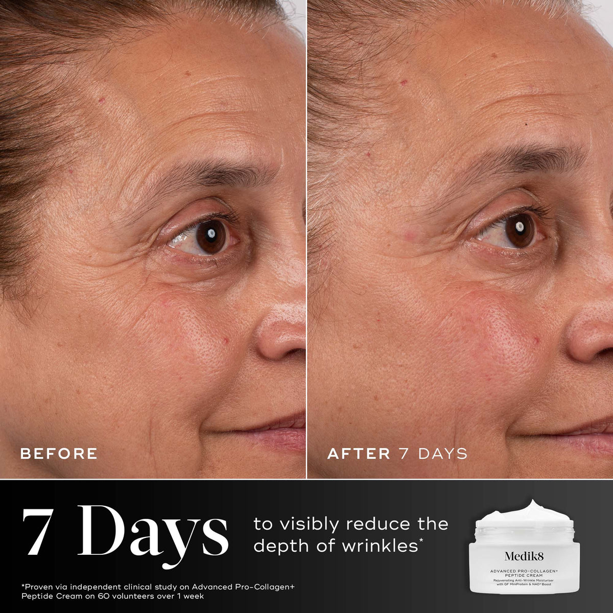 7 days - Before and after comparison of a participant’s eye area over 7 days displayed next to the Medik8 Advanced Pro-Collagen+ Peptide Cream jar. Text highlights that the product is proven to visibly reduce the depth of wrinkles in 7 days.