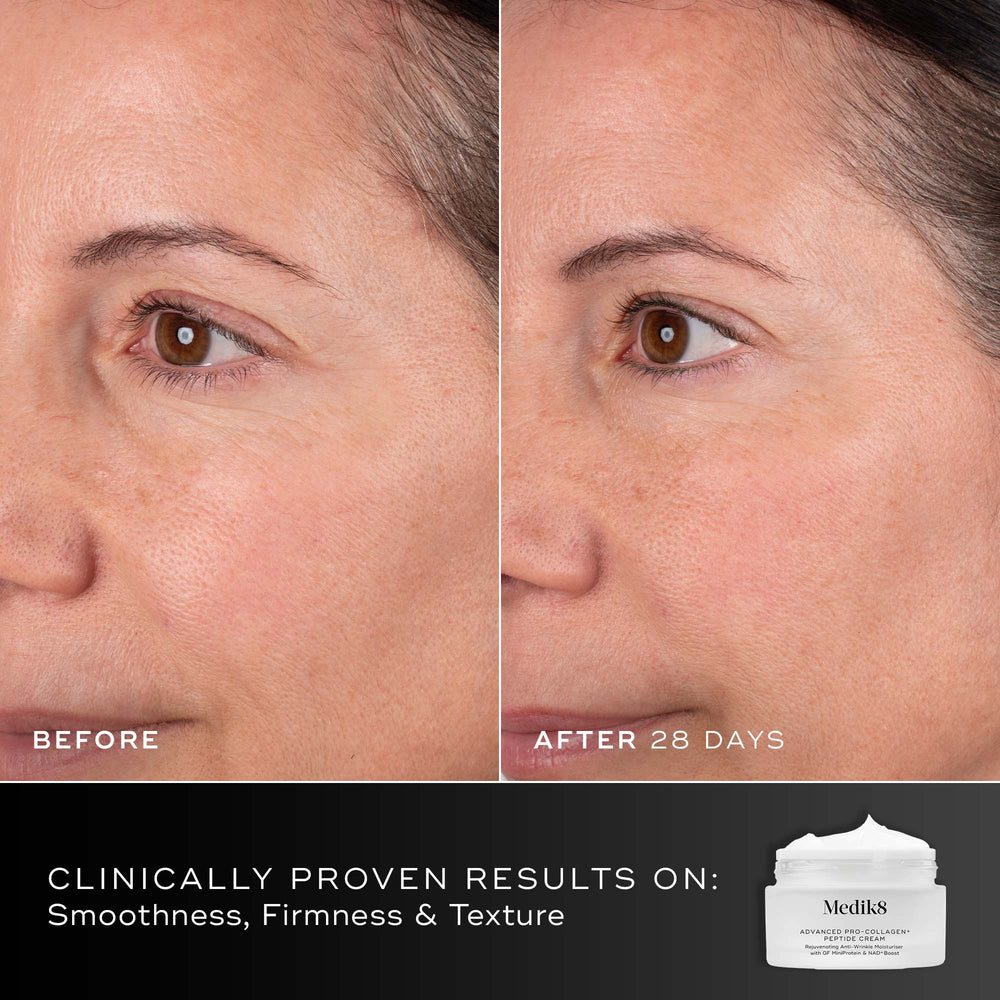 28 days - Before and after comparison of a participant’s face over 28 days displayed next to the Medik8 Advanced Pro-Collagen+ Peptide Cream jar. Text highlights clinically proven results on smoothness, firmness, and texture.