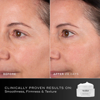 Before and after comparison of a participant’s face over 28 days displayed next to the Medik8 Advanced Pro-Collagen+ Peptide Cream jar. Text highlights clinically proven results on smoothness, firmness, and texture.