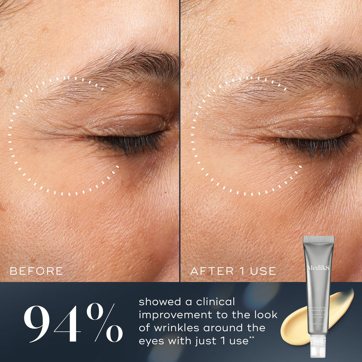 Crystal Retinal® Ceramide Eye