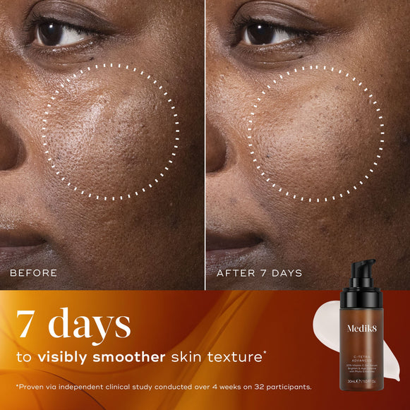 Before and after close-up of a participant’s skin over 7 days, demonstrating visibly smoother skin texture and refined appearance.-hover-5