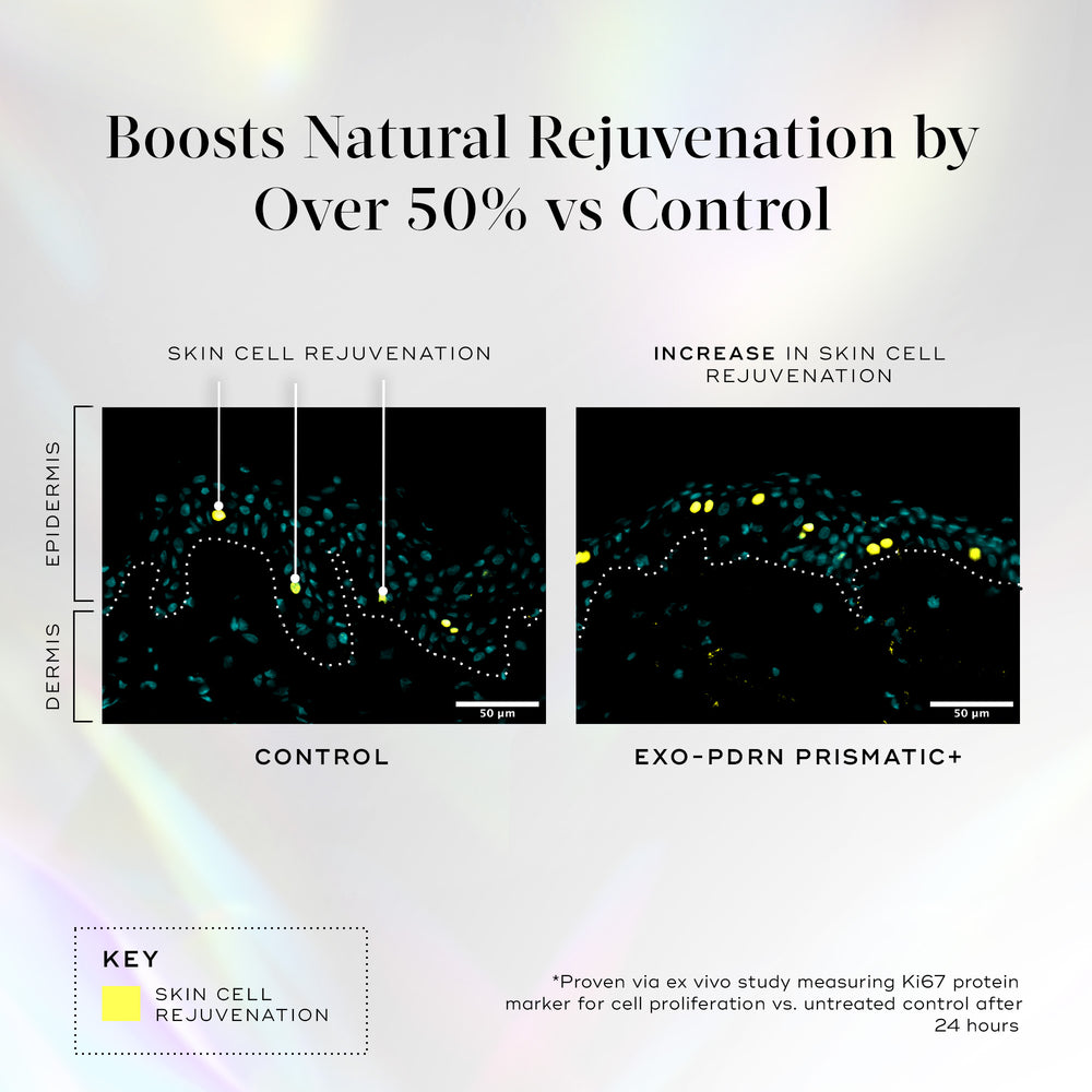 Scientific comparison of skin cell rejuvenation with control and exo pdrn prismatic+, showing text about natural rejuvenation boost by 50%.