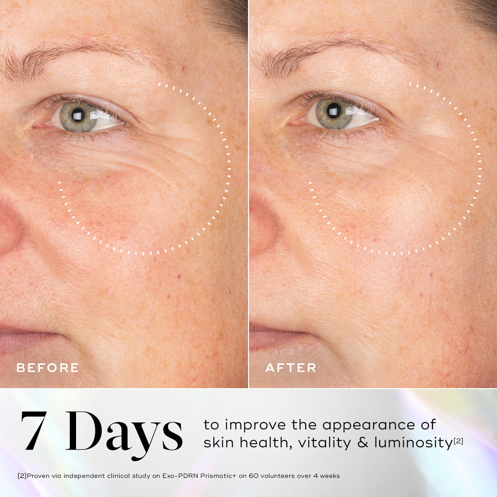 Before and after comparison of a person's outer eye area, with a dotted circle highlighting a visible reduction in crow's feet wrinkles. Below, large text states "7 days" to reveal healthier, radiant, and luminous-looking skin.