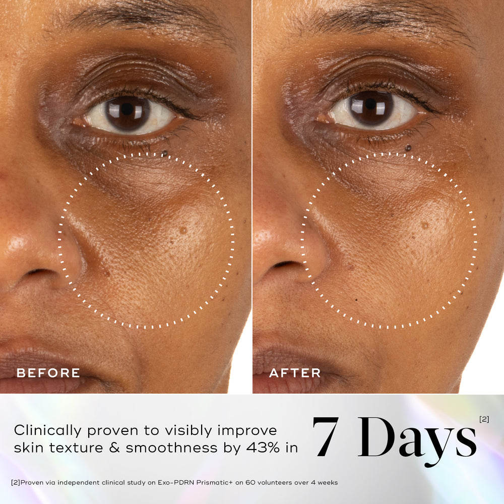 Before and after comparison of a person's under-eye and cheek area, with a dotted circle highlighting improved skin texture. Below, text states it is clinically proven that skin appears visibly smoother and softer by 43% in 7 days.