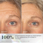 Before and after comparison of a person's forehead and eye area, with a dotted circle highlighting a visible reduction in forehead wrinkles. Below, large text states that 100% of participants noticed a visible reduction in wrinkles in 14 days.