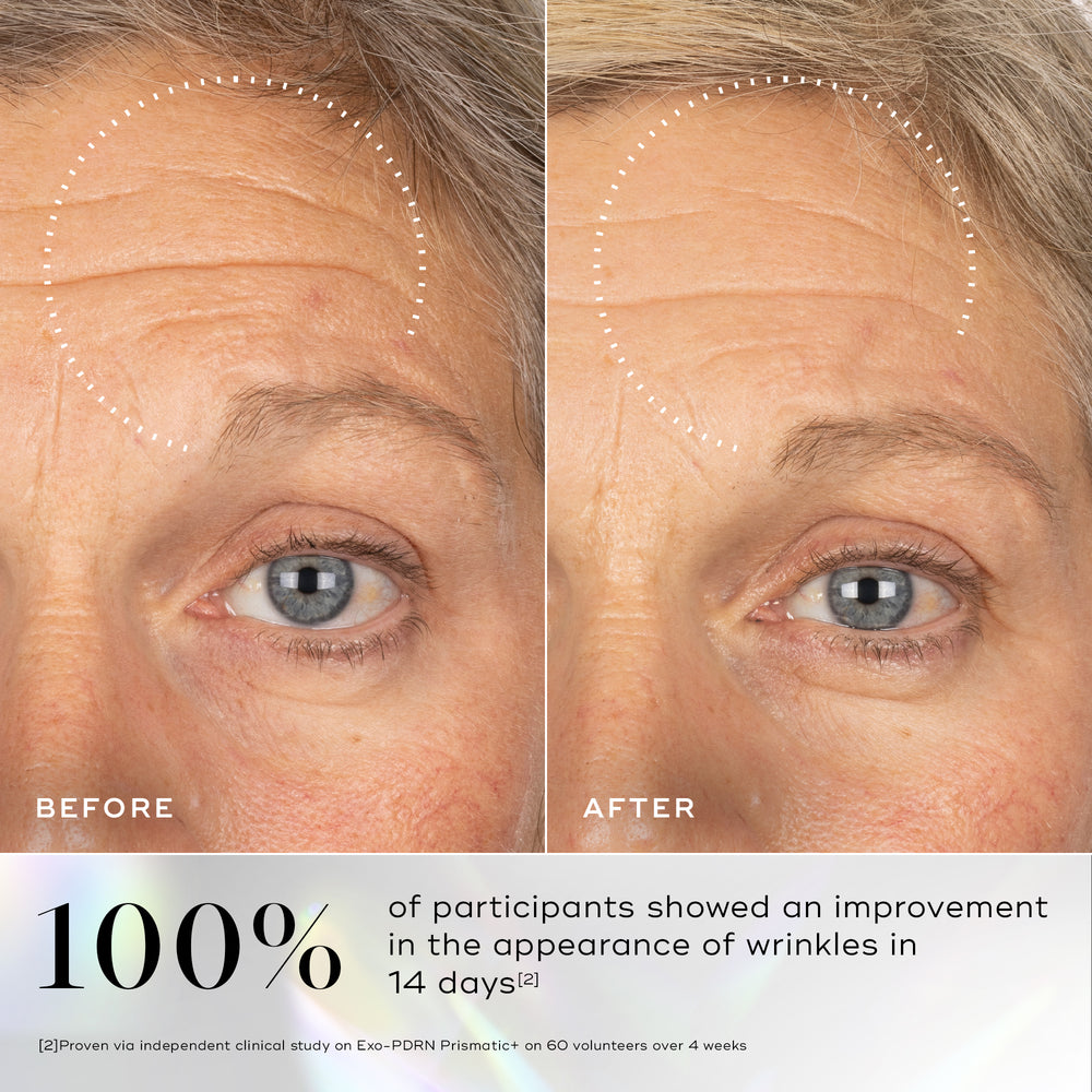 Before and after comparison of a person's forehead and eye area, with a dotted circle highlighting a visible reduction in forehead wrinkles. Below, large text states that 100% of participants noticed a visible reduction in wrinkles in 14 days.