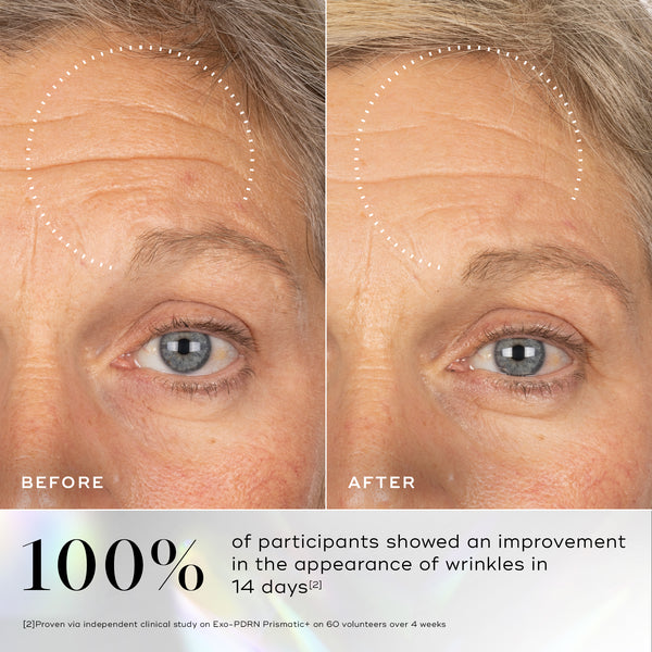 Before and after comparison of a person's forehead and eye area, with a dotted circle highlighting a visible reduction in forehead wrinkles. Below, large text states that 100% of participants noticed a visible reduction in wrinkles in 14 days.