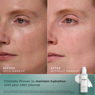 Side-by-side before and after images of a woman’s face showing improvement in hydration and skin clarity, alongside product and supporting claim text